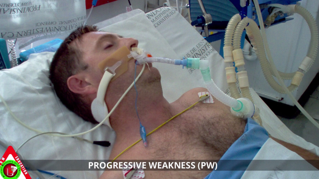 Progressive Weakness Syndrome